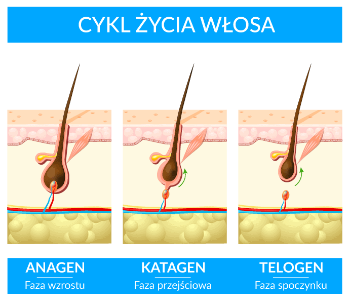 typy łysienia